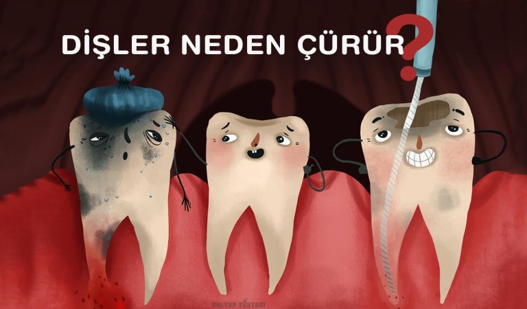 Dişler neden çürür?